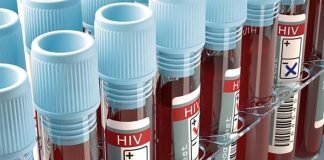 Giornata mondiale AIDS, HIV,