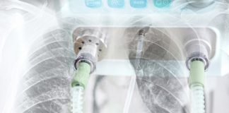 Donazioni all’ospedale di Monfalcone e alla Rianimazione di Trieste