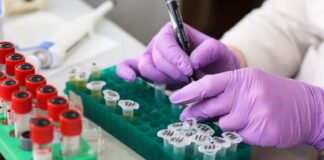 Diagnosticare un tumore dalle analisi del sangue, la promessa del test Galleri tumore test galleri