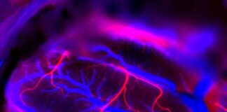 Neuralink Musk SISSA