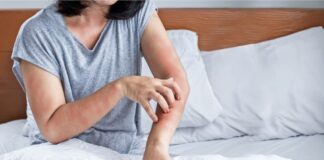 Arrossamenti cutanei e dermatite, come prevenire e curare l’acariasi acariasi