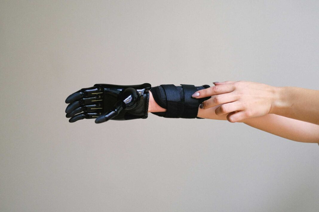 Immagine di protesi alla mano, progetto ReHand